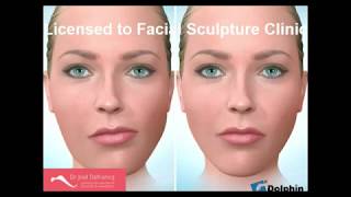 Facial Asymmetry Surgery歪臉 [upl. by Enitsyrk]