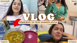 DIÁRIO DA MAMOPLASTIA REDUTORA  vlog dia da cirurgia PÓS OPERATÓRIO recuperação e sintomas 2 [upl. by Olyhs89]