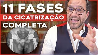 QUANTO TEMPO leva pra CICATRIZAÇÃO completa da CIRURGIA de prótese de quadril [upl. by Jeffy79]