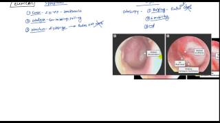 Acute Otitis Media and Otitis Media with Effusion for USMLE Step 2 [upl. by Niaz894]