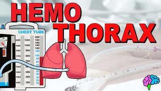 What is a Hemothorax EXPLAINED [upl. by Schramke]