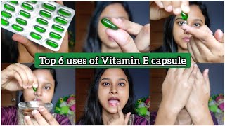 Top 6 uses of Vitamin E For Face Skin  Vitamin E Oil Skin Treatment  Benefits of Vitamin Eবাংলা [upl. by Gruver]