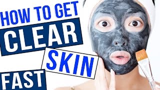 HOW TO Get Clear Skin FAST [upl. by Uhile]