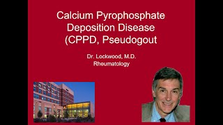 10 Calcium Pyrophosphate Deposition Disease Pseudogout [upl. by Attehcram393]