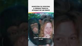 Mujer atacada por chimpancé muestra su rostro a Oprah Shorts [upl. by Ulyram]