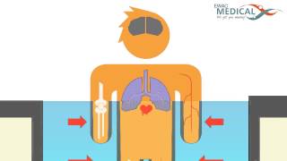 EWAC Medical  Physiological aspects of Hydrotherapy [upl. by Genevieve]