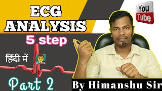 How To Read An ECG ECG Report  ECG Report Reading  ECG Report kaise Pade  Doctor hos himanshu sir [upl. by Thorvald140]