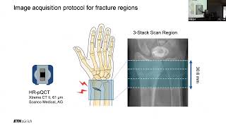 Investigating the complexities of bone adaptation during fracture healing in vivo imaging [upl. by Mechling]