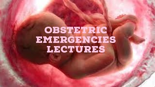 OBSTETRIC EMERGENCIES lecture 2 POST PARTUM HEMORRAHGE all important points [upl. by Cari]