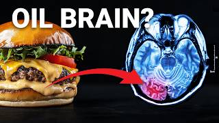 The 212 Billion Dollar Food ingredient poisoning your Brain [upl. by Malan]