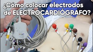 ¿Cómo colocar los electrodos de un electrocardiógrafo [upl. by Dennet]