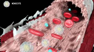 Development of atherosclerosis [upl. by Runstadler]