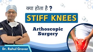 What is a Stiff Knee  Surgical Treatment amp Medical Treatment  Dr Rahul Grover  Hindi [upl. by Haberman772]