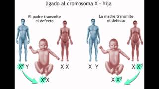 Distrofia muscular de Duchenne [upl. by Menis]