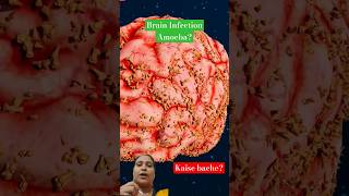 Naegleria Fowleri viralvideo science facts shortfeed shorts [upl. by Oiramal]