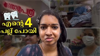 4 പല്ല് പറിച്ചു  പല്ലിന് കമ്പി ഇടാൻ ഉള്ള ഒരുക്കങ്ങൾ  teeth braces malayalam teethbracesmalayalam [upl. by Luby]