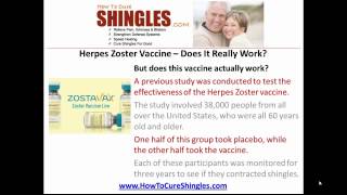 Herpes Zoster Vaccine  Does It Really Work [upl. by Acirrej]