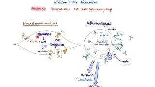 Brandls Basics Asthma Treatment [upl. by Nahtannhoj586]