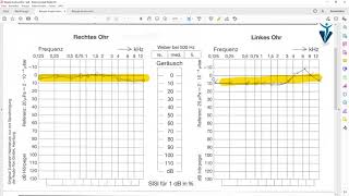 Was ist ein Hörtest Verbesserungen sind möglich [upl. by Ahsienor]
