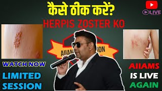 HERPES ZOSTER का सेशन TYPES CAUSES TREATMENT AIIAMS EDUCATION IS LIVE AGAIN DR RAKESH [upl. by Simaj]