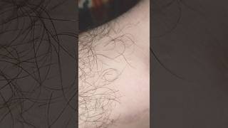 hair removal removery hairstyle haircare [upl. by Itsur]