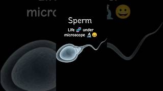 Semen Analysis The Science of Your Swimmers🔬🧬😀sperm [upl. by Nwahser]