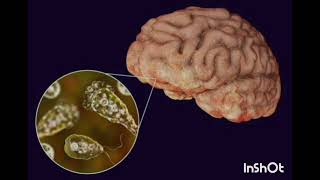 OUR INNOVATION AGAINIST BRAIN EATING AMOEBA  NAEGLERIA FOWLERI 🧠 🦠DHWANEERAVAM VLOGZZ [upl. by Ahsita826]