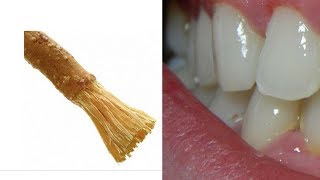 5 Reasons To Brush Your Teeth With A Miswak Stick [upl. by Livvy]