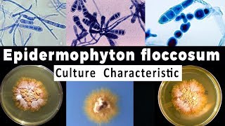 Epidermophyton Flocusum Culture Characteristic [upl. by Rachele]