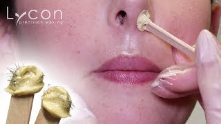 Vanilla Scented Nose Wax With LYCOflex  LYCON Cosmetics [upl. by Mallina]