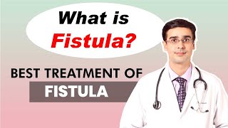 What is Fistula  Best Treatment For Fistula In India  Dr Anirudh Vij [upl. by Ahsikat]