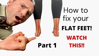 HOW TO FIX YOUR FLAT FEET Part1 [upl. by Mann]