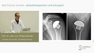 «Wann anatomische wann inverse Endoprothesensysteme»  Prof Philipp Moroder Schulthess Klinik [upl. by Islean]