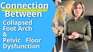 Connection Between Collapsed Foot Arch amp Pelvic Floor Dysfunction FootPain ArchSupport [upl. by Warner]