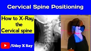 Cervical Spine Xray Positioning  AP amp Lateral View  Uday X Ray [upl. by Yerak]