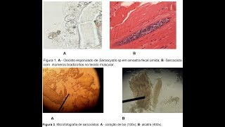 Parasitologia  Sarcocistose Prof Lucas Barbosa [upl. by Gaby]