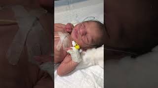 Newborn baby moving his lips youtubeshorts nursing medical newbornbaby cutebaby viralvideo [upl. by Matty]