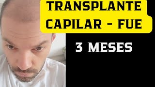 TRANSPLANTE CAPILAR  FUE 3 MESES PÓS OPERATÓRIO [upl. by Yenatirb420]