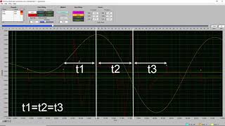 Estimating Beats HRVIMP 32 [upl. by Cortie735]