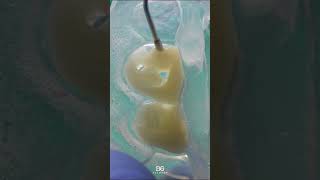 Composite veneers veneers bonding dentistry [upl. by Flagler876]