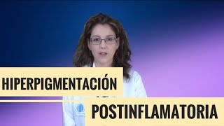 HIPERPIGMENTACIÓN POSTINFLAMATORIA [upl. by Jollanta]