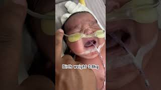 Chubby baby ampHealthy in Nicu ankur maitrika hospital ❤️ [upl. by Enael595]