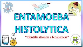 Entamoeba Histolytica  Morphology of the Trophozoite amp Cyst on Light Microscope Stools for AOC [upl. by Maiah]