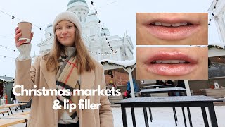 week in my life vlog Finnish Christmas market and getting lip filler [upl. by Anayi]