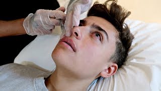 Getting LIP FILLERS For The First Time Not Clickbait [upl. by Odraleba2]