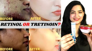 क्या USE करें RETINOL or TRETINOIN Which is Better Retinol and Retin A Which Should You Pick [upl. by Ilesara]