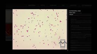 Actinobacillus ureae  Microbiology [upl. by Ecyor]