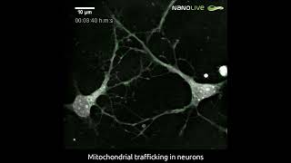 Visualizing mitochondrial trafficking in neurons [upl. by Richel]