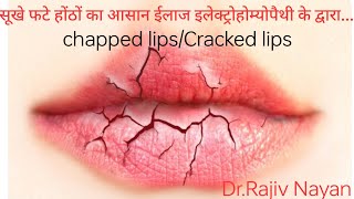 405 Chapped lipsCracked lips सूखे फटे होठों का आसान ईलाज EH पैथ के द्वारा [upl. by Komarek]