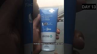 Day13 of using sali cinamide face wash  0 to 30 days challenge  shorts grooming challenge [upl. by Gaivn782]